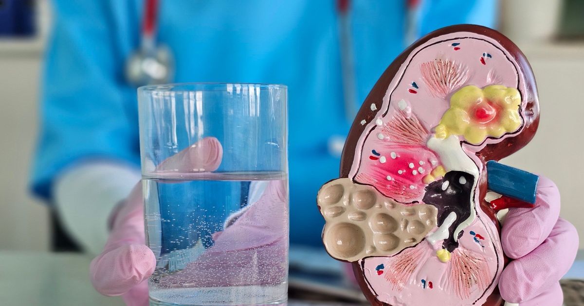 هل شرب المياه بكثرة ينظف الكلى فعلاً؟ حقائق علمية تصحح المفاهيم الشائعة